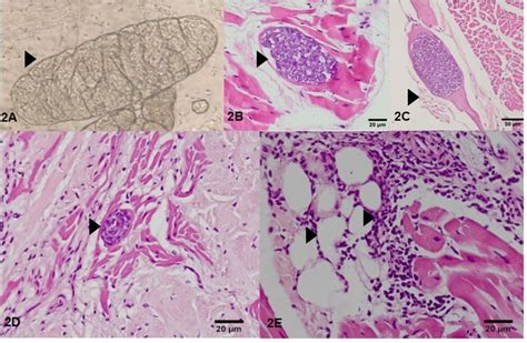  Sarcocystis – Parasitic Powerhouse Lurking Within Muscle Tissue!