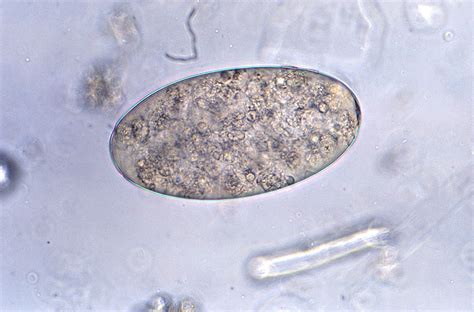  Fasciolopsis buski - Parasittivainen teurastaja, joka piileskelee vesikasvien varjossa!